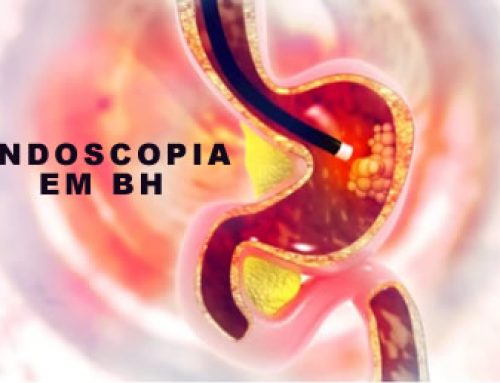 Endoscopia