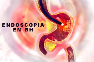 Endoscopia