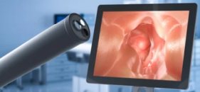 endoscopia em BH 3