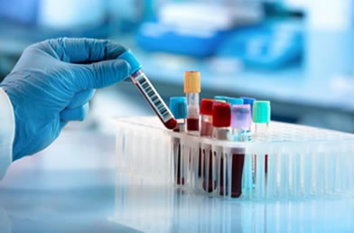 exames laboratoriais em BH